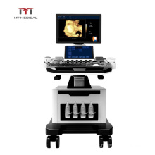 ultrasound machine/Hand-carried Portable Color Doppler  trolley Ultrasound machine